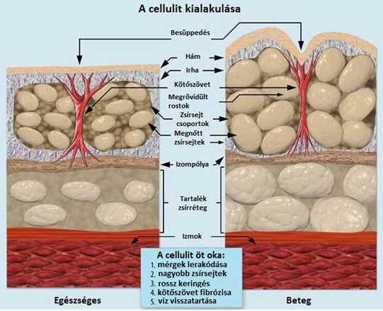 zsírsejt égés